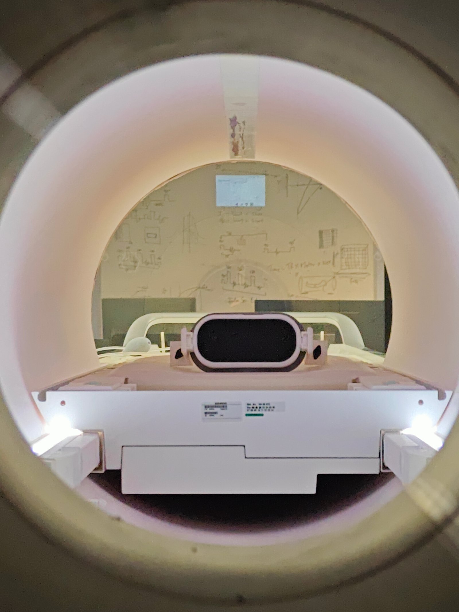 The view a patient sees looking up into the bore of the scanner from the treatment couch